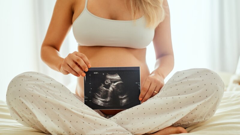 L’endométriose, liée à un taux de grossesse quatre fois supérieur aux autres causes d’infertilité