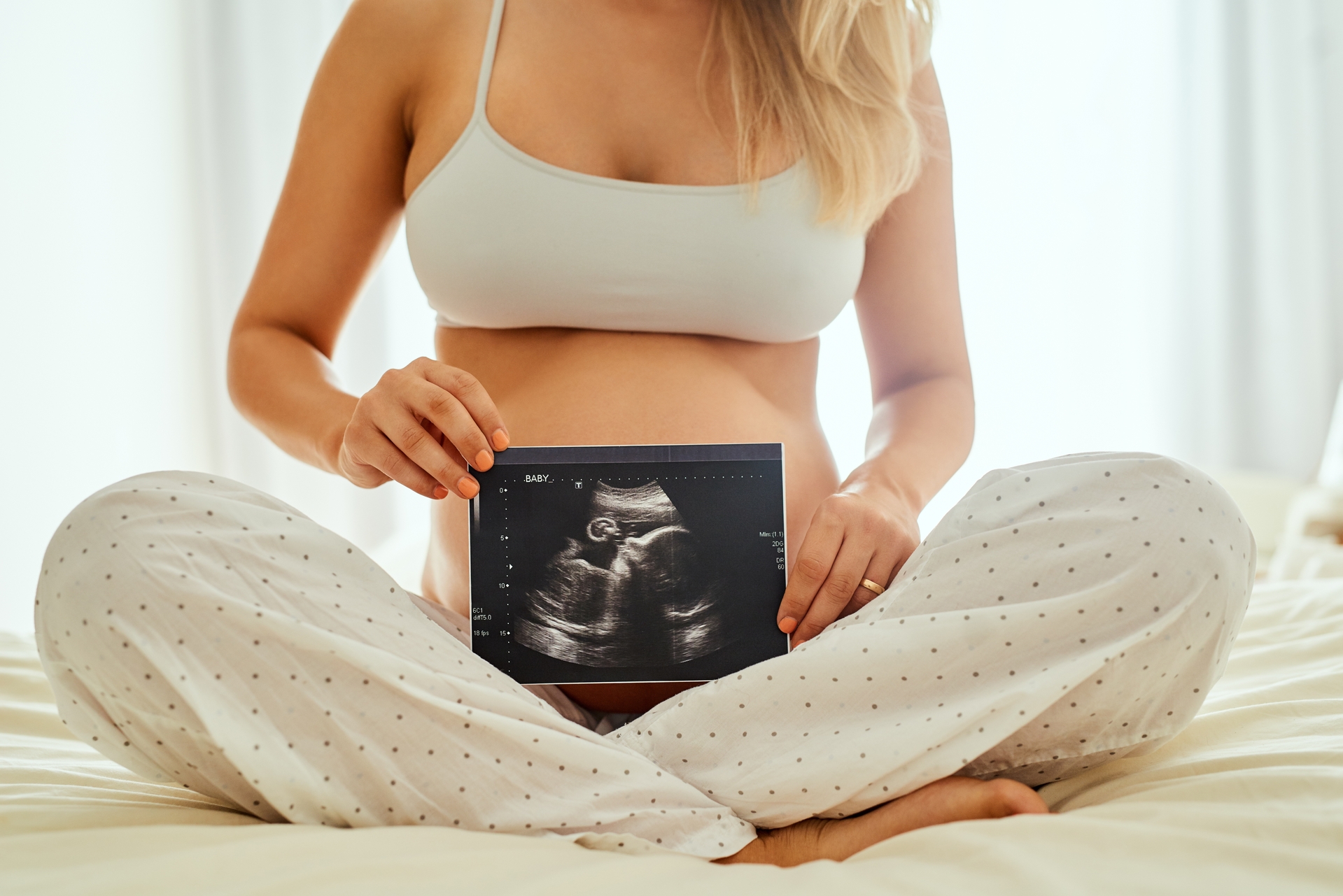 L’endométriose, liée à un taux de grossesse quatre fois supérieur aux autres causes d’infertilité