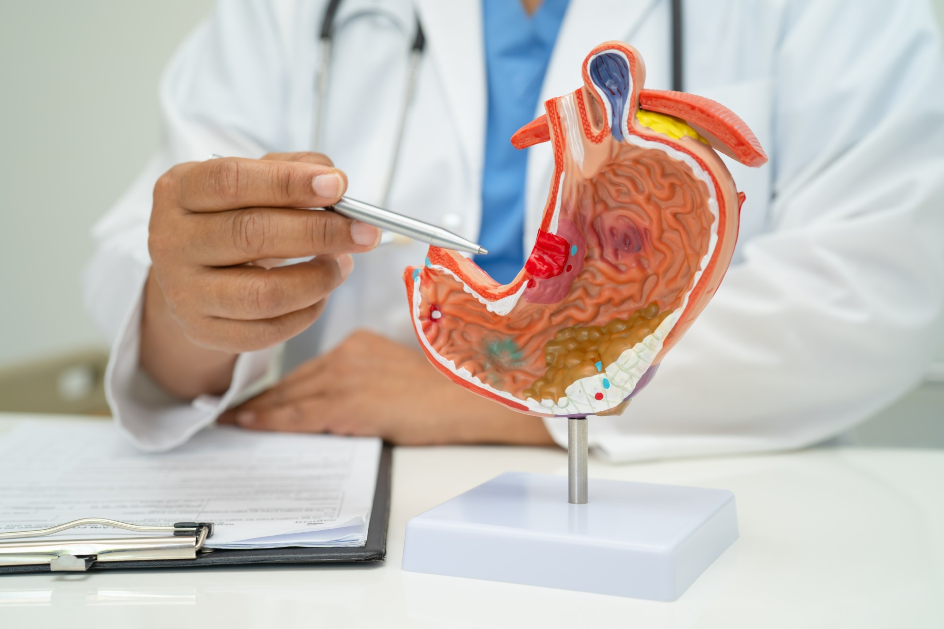 Cancers gastriques : un meilleur dépistage, une urgence mondiale