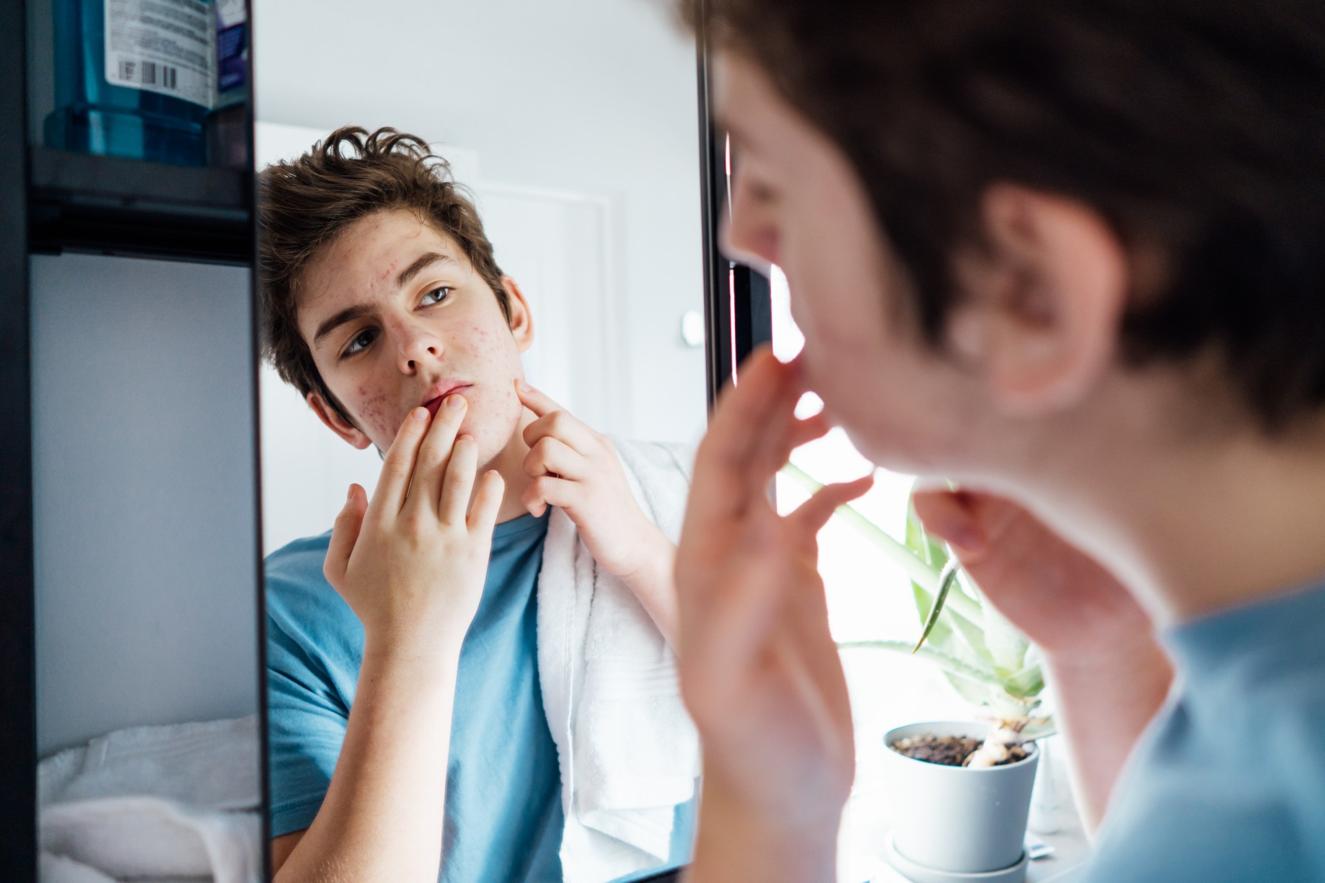 Acné : l’Agence européenne du médicament approuve un traitement novateur pour les adolescents