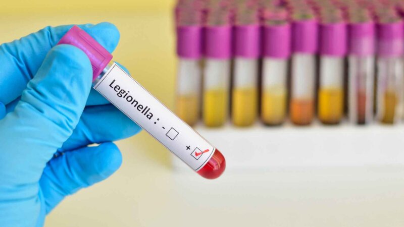 17 cas de légionellose à Albertville : 5 choses à savoir sur cette infection