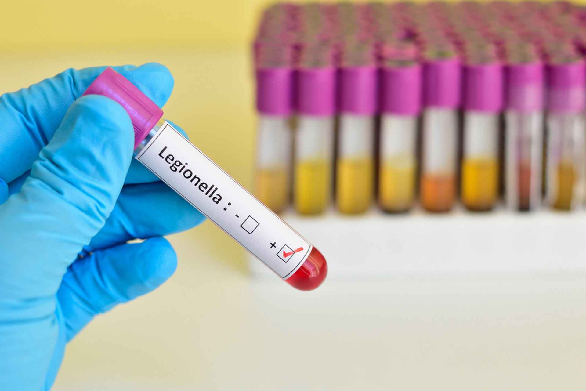 17 cas de légionellose à Albertville : 5 choses à savoir sur cette infection