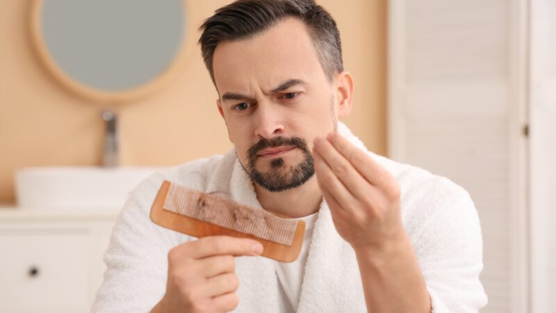 Où en sommes-nous dans le traitement de la calvitie ?