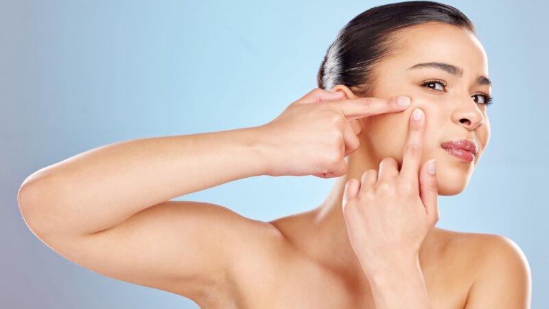 Pourquoi ne faut-il pas percer ses points noirs ?