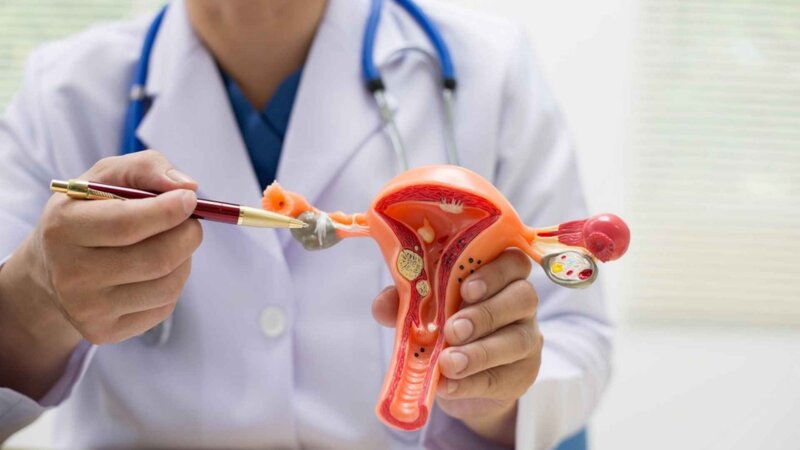 Cancer de l’ovaire : un suivi gynécologique, même après la ménopause, est primordial