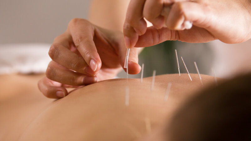 Acupuncture : que dit la science ?