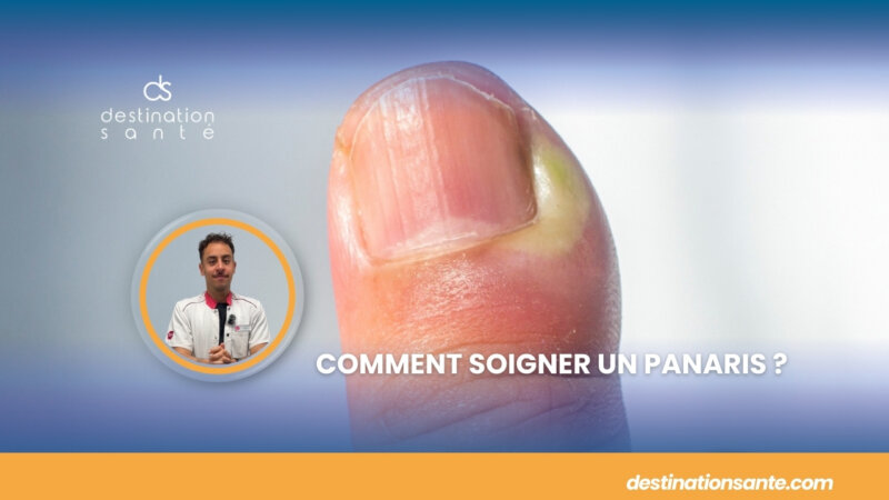 Comment soigner un panaris ? (Vidéo)