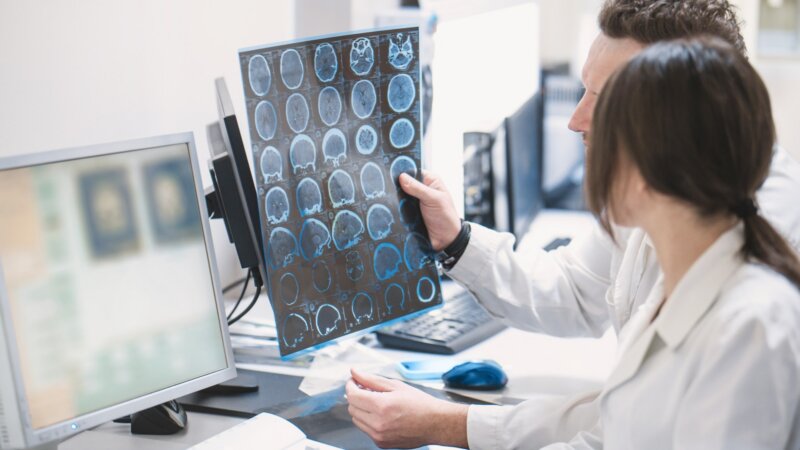 Qu’est-ce que la thrombolyse, le traitement d’urgence des AVC ischémiques ?