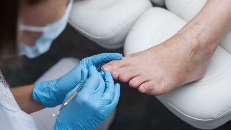 Vos ongles de pieds pourraient révéler votre risque de cancer du poumon