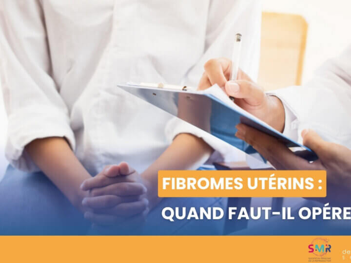 Fibromes utérins : quand faut-il opérer ? (Vidéo)