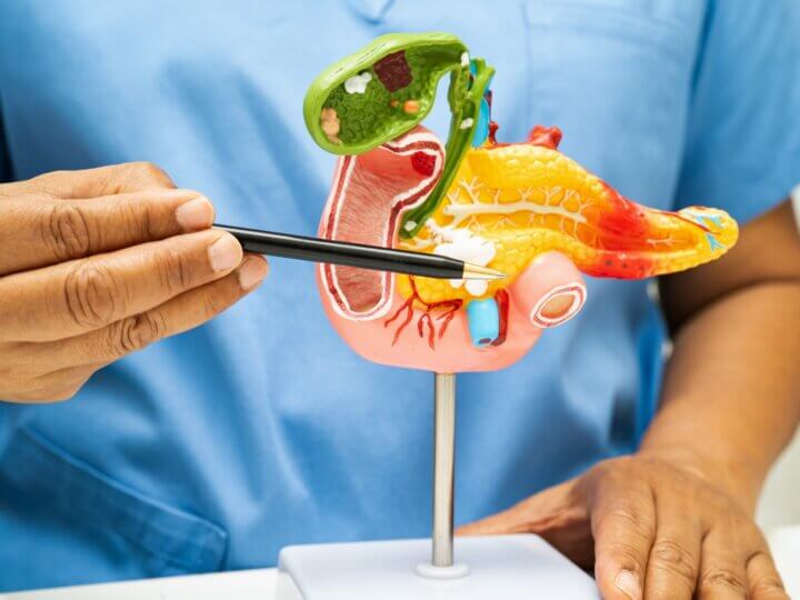 Cancer du pancréas : bientôt le 2ème cancer le plus meurtrier