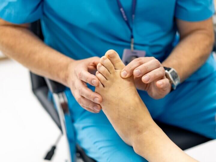 Ulcère du pied diabétique : 24 % d’amputations dès le 1er épisode