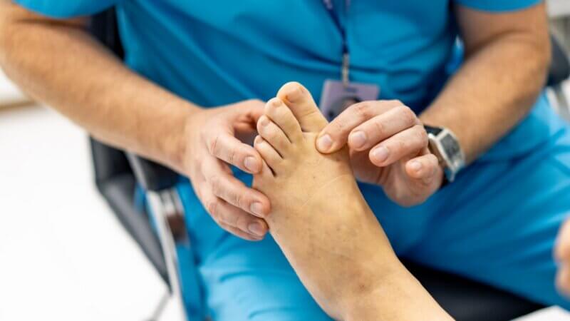 Ulcère du pied diabétique : 24 % d’amputations dès le 1er épisode