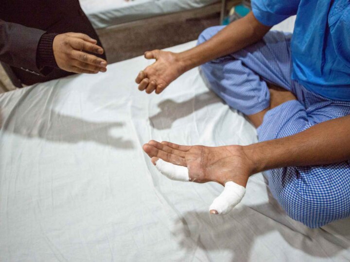 Disparue depuis des décennies, la lèpre de retour en Europe ?