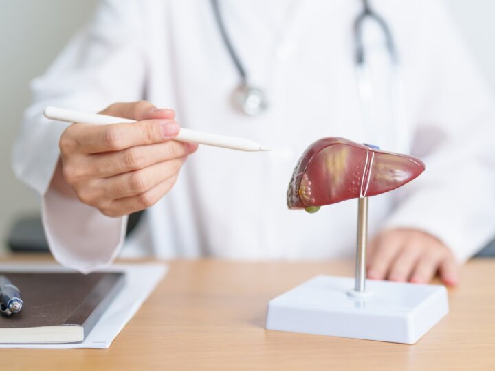 Maladie du foie gras : une pandémie méconnue des Français