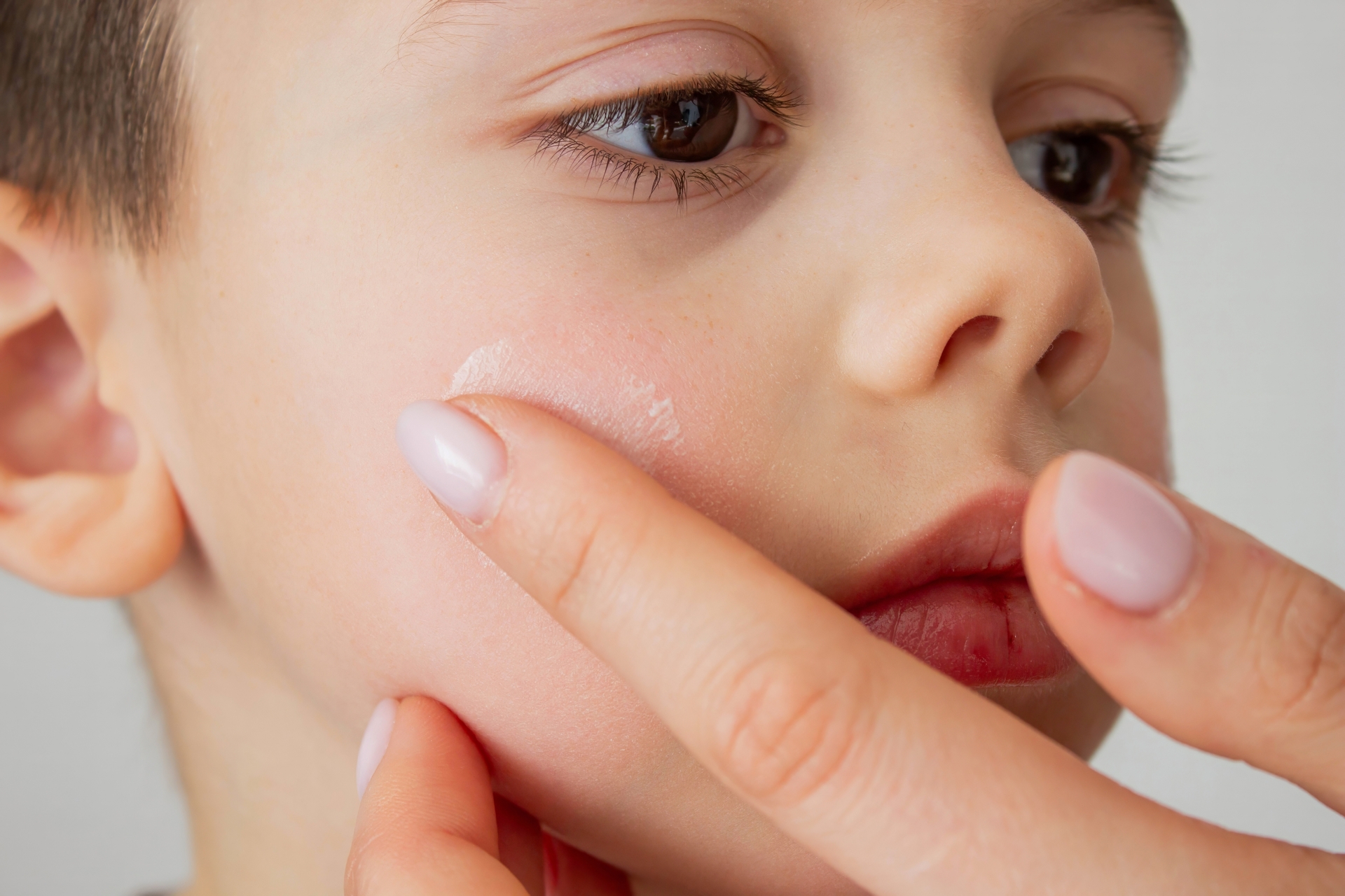 6 conseils pour soulager la peau sèche des enfants
