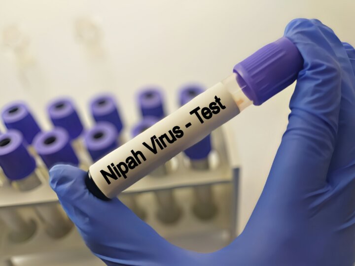 Nipah : 5 choses à savoir sur ce virus transmis par les chauves-souris