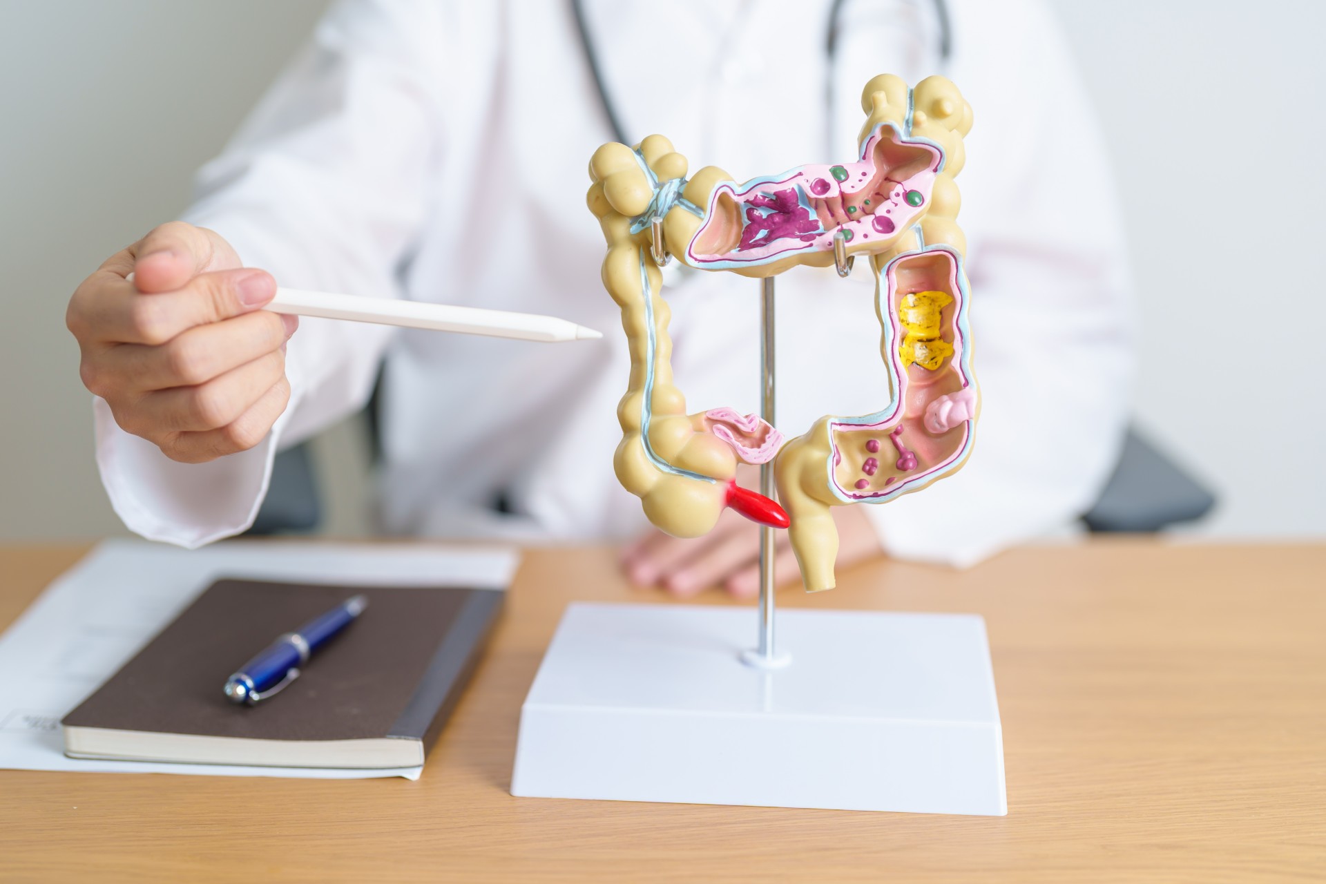 Cancer colorectal : quels sont les 3 comportements protecteurs et les 3 à éviter ?  